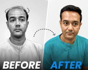 Instant Hair Transformation