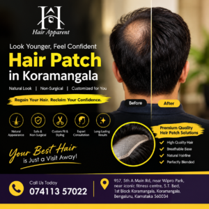 Hair Patch in Koramangala