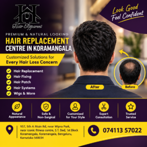 Hair Replacement Centre in Koramangala