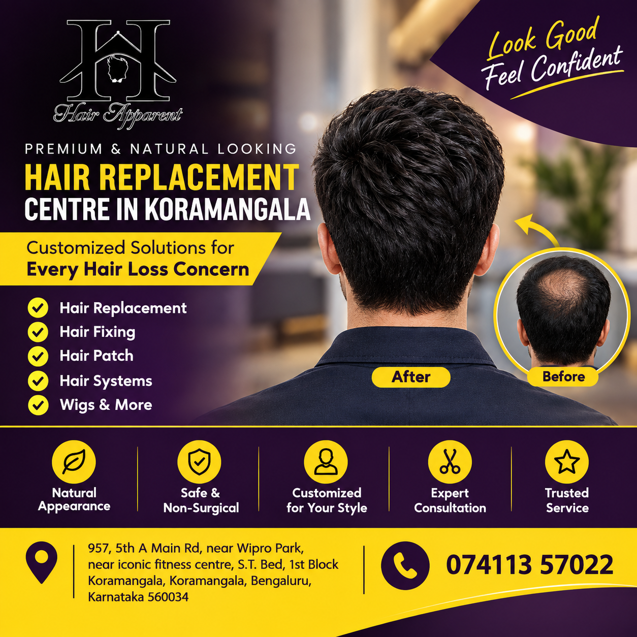 Hair Replacement Centre in Koramangala